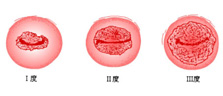 慈溪人流醫(yī)院
